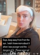 佩特拉·埃克莱斯顿（Petra Ecclestone）分享了头上缠着绷带的照片，并警告“远离阳光”，引发关注