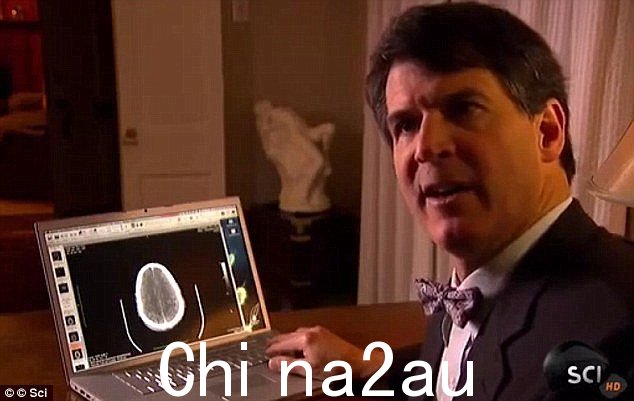 Eben Alexander 博士说，他在被诊断出患有脑膜炎而陷入昏迷后，被带去“穿越一系列领域的航行”” class=