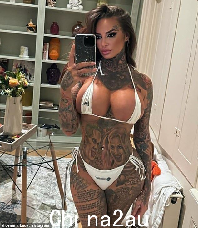 Jemma Lucy 透露了她是多么容易成为牛仔从业者注射填充剂的“合格者”，以及她自己被搞砸的经历