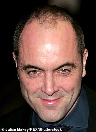 James Nesbitt 2005 年植发前的照片