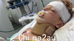 珀斯男孩约书亚·舒茨 (Joshua Schuetz) 在巴厘岛发生恐怖事故后为生命而战