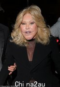 84 岁的乔斯琳·维尔登斯坦 (Jocelyne Wildenstein) 声称，她从未做过整形手术，并且“讨厌肉毒杆菌”，尽管她的面部发生了巨大的变化，而且医生声称她做过